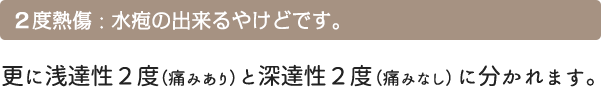 2 度熱傷 : 水疱の出来るやけどです。 更に浅達性２度（痛みあり）と深達性２度（痛みなし）に分かれます。