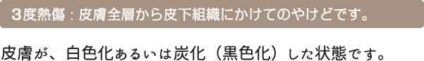 3 度熱傷 : 皮膚全層から皮下組織にかけてのやけどです。 皮膚が、白色化あるいは炭化（黒色化）した状態です。