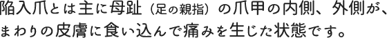 陥入爪とは主に母趾（足の親指）の爪甲の内側、外側が、まわりの皮膚に食い込んで痛みを生じた状態です。